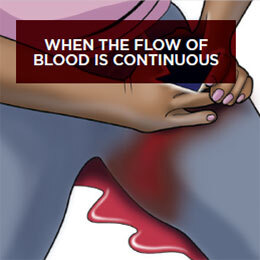 Stop the bleed step 11